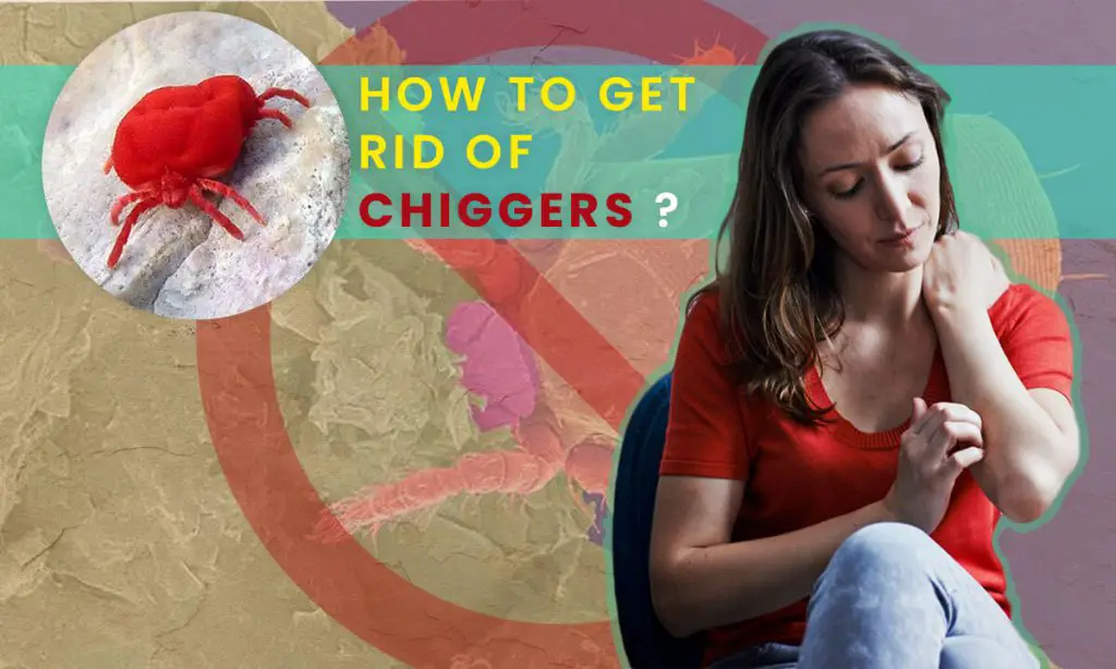How to Get rid of Chiggers